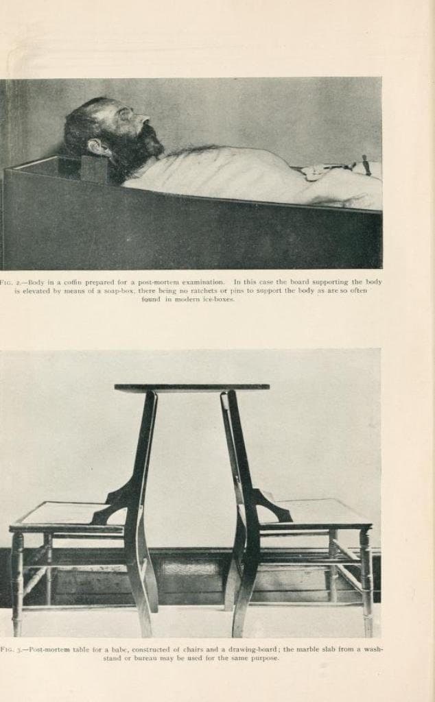46 Rare Old Books on Pathology Human Autopsy Forensic Pathology Post Mortem Medical Science Anatomy Mortuary Coroner - INSTANT PDF Download - image 5